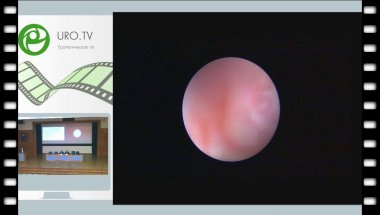 Ергаков Д.В. - Инновации в перкутанной хирургии