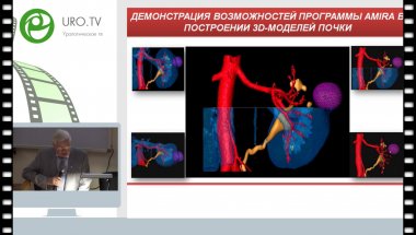 Аляев Ю.Г. - Современные тенденции диагностики и лечения рака почки