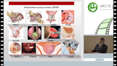 Комяков Б.К. - Осталось ли место открытой аденомэктомии среди современных методов оперативного лечения больных доброкачественной гиперплазией простаты?