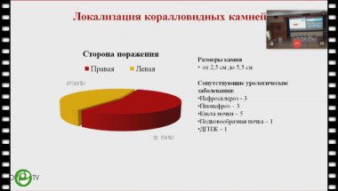 Капсаргин Ф.П. - Коралловидный нефролитиаз