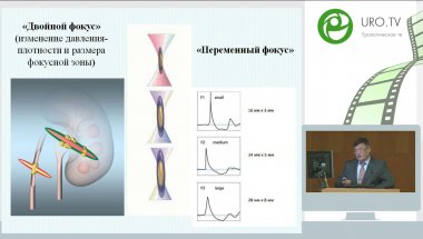 Руденко В.И. - Современные аспекты клинической эффективности ДЛТ