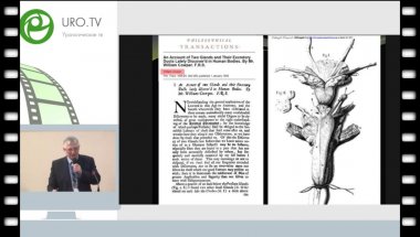 Осипов И.Б. - Успешный результат малоинвазивного лечения спрингоцеле куперовой железы