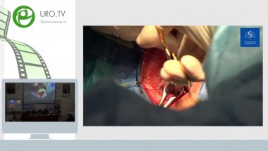 Бутнару Д.В., Безруков Е.А., Еникеев М.Э. - Видеосессия Живая хирургия