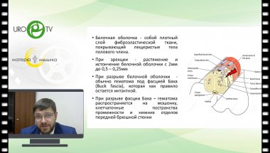 Беломытцев С.В. - Перелом полового члена