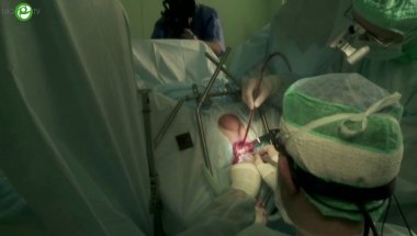 Живов А.В. - Пластика при структуре уретры