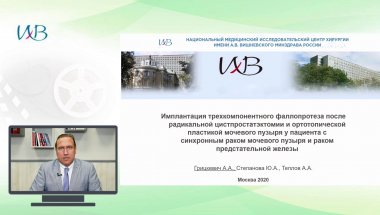 Имплантация трехкомпонентного фаллопротеза после радикальной цистпростатэктомии с ортотопической пластикой мочевого пузыря у пациента с синхронным раком мочевого пузыря и раком простаты