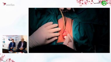 Шкодкин С.В. - Манчестерская операция, субуретральный слинг