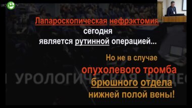 Галлямов Э.А. - Лапароскопическая нефрэктомия