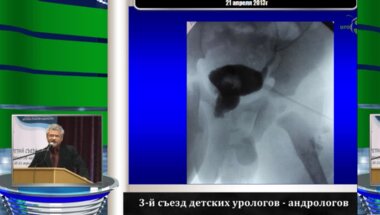 Файзулин А.К. "Значение клеточных технологий при восстановлении поврежденной уретры у детей"