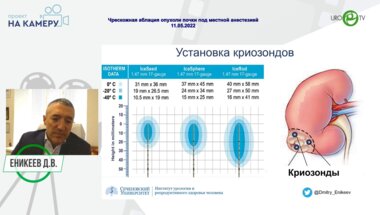 Еникеев Д. В. - Чрескожная аблация опухоли почки под местной анестезией