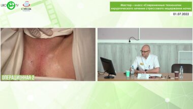 Операция 4. Слинг уретры у пациента со стрессовым недержанием мочи