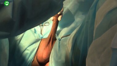 Курбатов Д.Г. - Пластика уретры