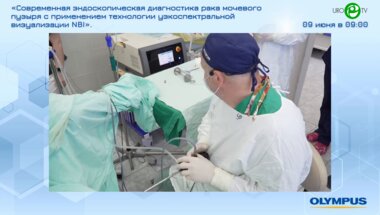 Фатихов Р.Р. - Трансуретральная лазерная En Bloc резекция стенки мочевого пузыря с опухолью с применением NBI-визуализации