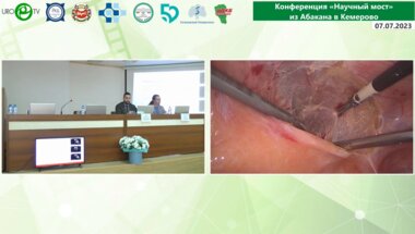 Безруков Е.А. - Лапароскопическая аденомэктомия