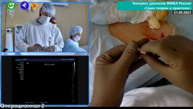 Данилов А.А. - ПНЛЛ под УЗИ-наведением