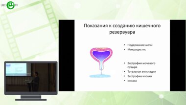 Даренков С.П., Пинчук И.С., Коварский С.Л., Захаров А.И., Петрухина Ю.В. - Артифициальный мочевой пузырь у ребенка с клоакой
