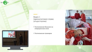 Франк М.А., Михельсон А.А., Мурзин М.О., Замятин А.В., Санжаров А.Е., Шамуратов Р.Ш. - Лапароскопическая адреналэктомия