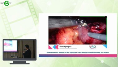 Котов С.В., Тызьо Д.В., Кобзев Д.С., Юсуфов А.Г., Гуспанов Р.И., Мещанкин И.В., Пироженко Г.А. - Хирургия единственной почки