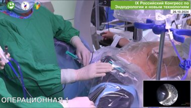 Мартов А.Г, Андронов А.С. - ECIRS. Микроперкутанная и трансуретральная лазерная нефролитотрипсия