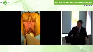 Комяков Б.К. - Экстравагинальная транспозиция уретры с клиновидной резекцией её дистальной части