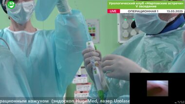 Малхасян В.А. - Ретроградная нефролитотрипсия с аспирационным кожухом (эндоскоп HugeMed, лазер Urolase)