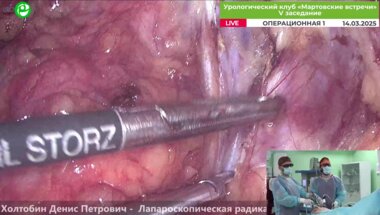 Холтобин Д.П. -  Лапароскопическая радикальная простатэктомия (энергия BOWA)