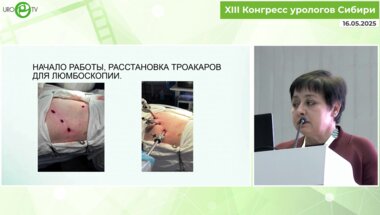 Ильинская Е.В. - Возможности люмбоскопического доступа
