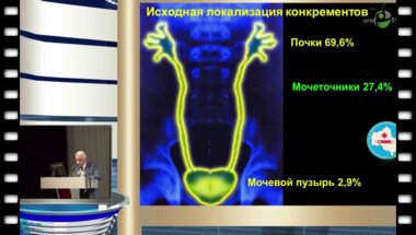 Дутов В.В. - "Новые подходы к медикаментозному лечению камней мочеточника"