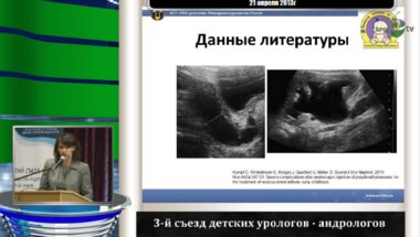 Гарманова Т.Н. "Снижение функции почки менее 70% - прогностический фактор возникновения обструкции устья мочеточника"
