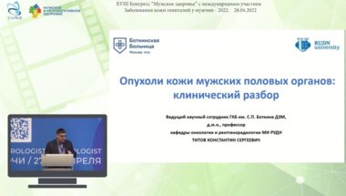 Титов К.С. - Опухоли кожи мужских  половых органов: клинический разбор