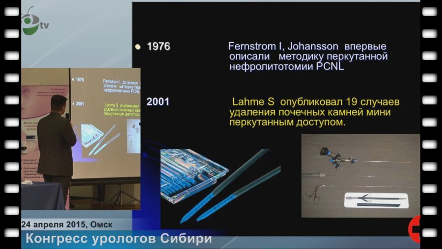 Макаров П.А. - "Первый опыт применения миниперкутанной нефролитотомии"