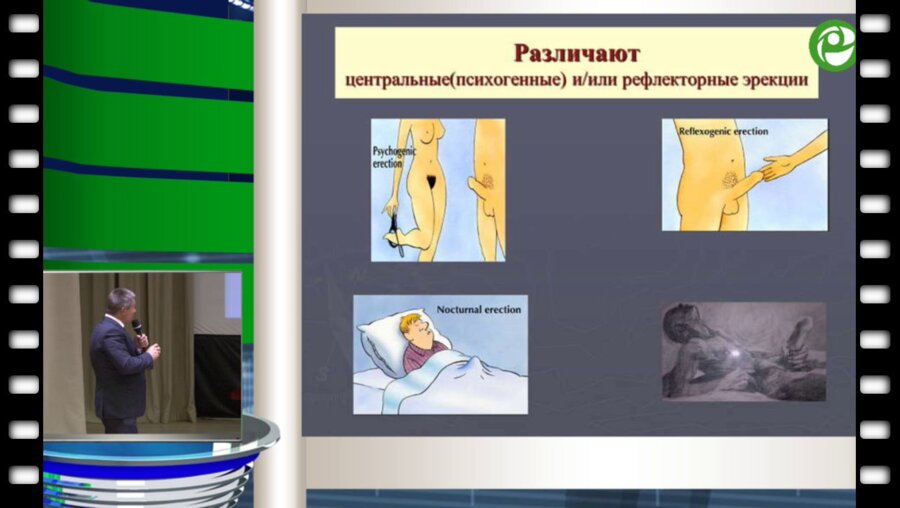 Жуков О.Б. - Нейрогенная эректильная дисфункция