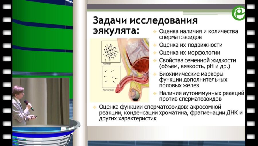 Божедомов В.А. - Исследование эякулята: современные требования к лабораторной диагностике и клиническая интерпретация результатов