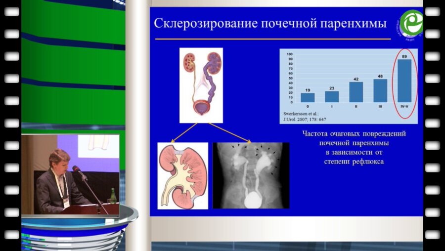 Шахновский Д.С. - Молекулярно-генетическая диагностика пузырно-мочеточникового рефлюкса