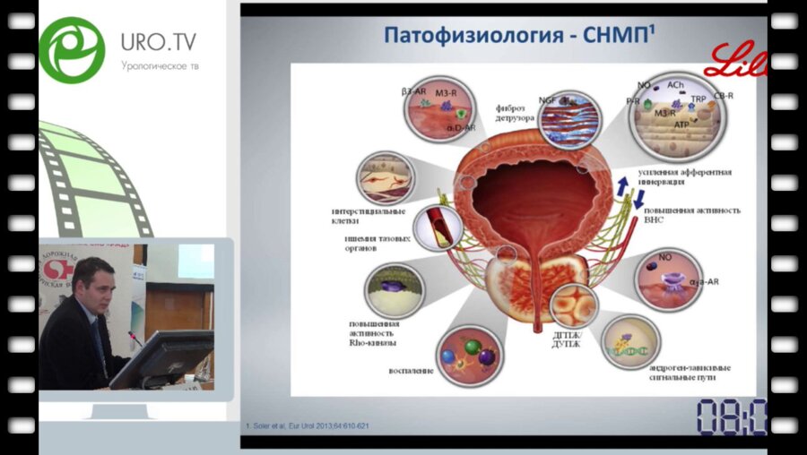 Цуканов А.Ю. - Консервативное или оперативное лечение ДГПЖ. Как принять решение согласно современным международным рекомендациям