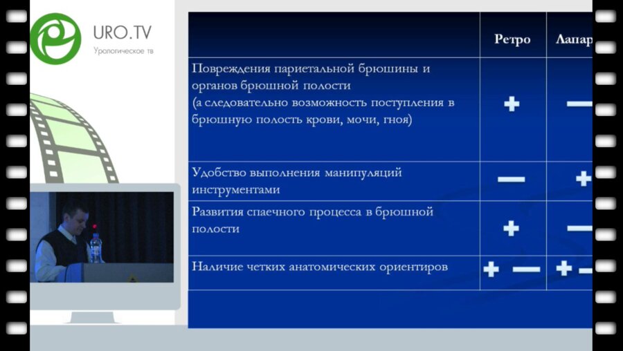 Текотов А.Н. - Ретроперитонеоскопический доступ при простом врожденном гидронефрозе у детей