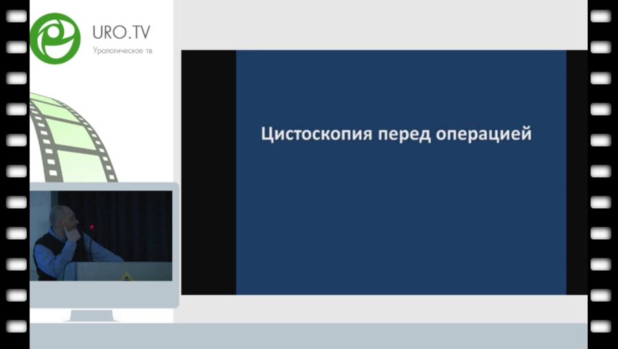 Каганцов И.М. - Лапароскопический уретеропиелоанастомоз при обструкции ВУС верхнего полюса правой почки