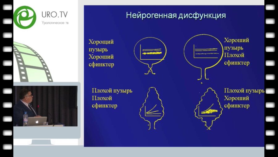 Tekgul S. - Нейрогенная дисфункция мочевого пузыря