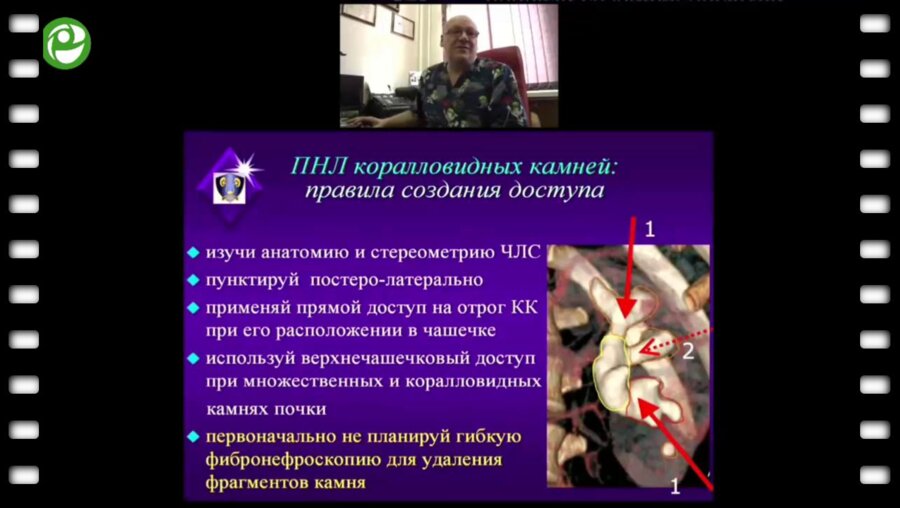 Мартов А.Г. - Перкутанное лечение коралловидного нефролитиаза