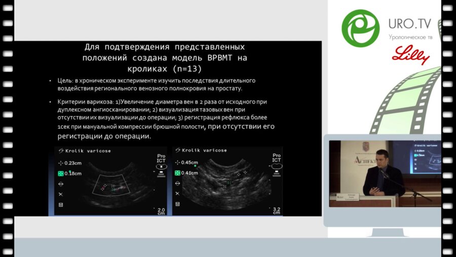Цуканов А.Ю. - Первичный и вторичный варикоз малого таза в практике амбулаторного уролога