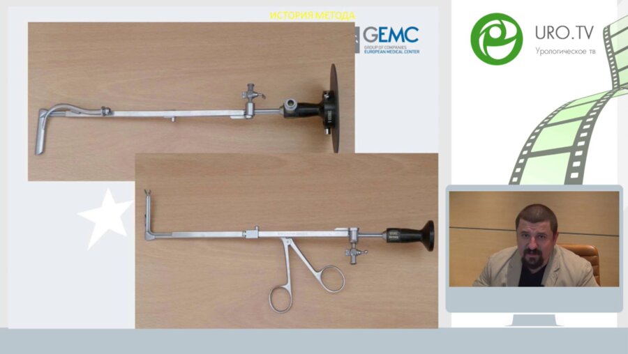 Час с ведущим урологом: Малоинвазивные методики лечения МКБ: когда, кому, чем?
