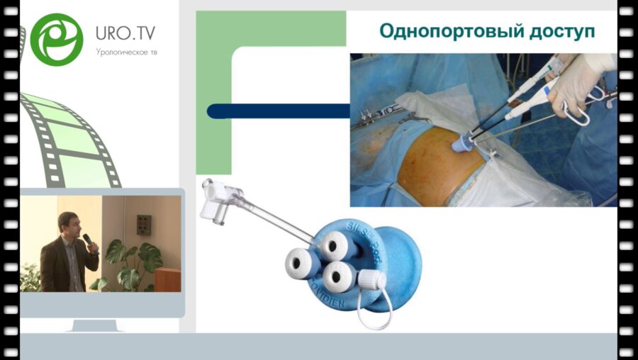 Богомолов О.А. - Лапароскопические трансумбиликальные резекции почек: собственный опыт