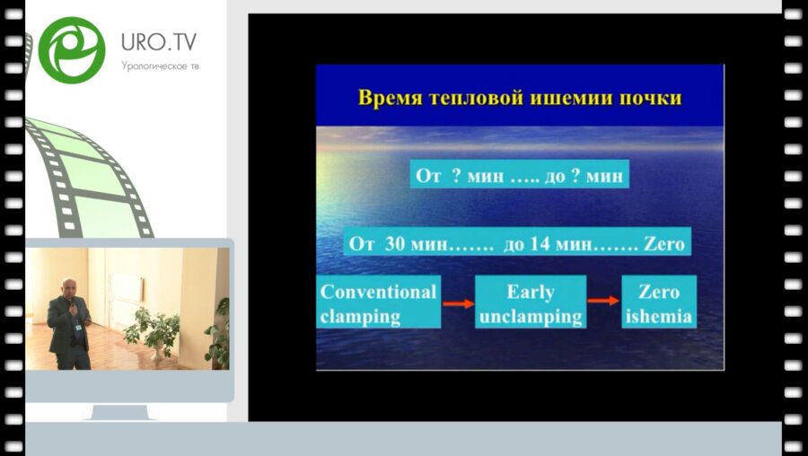 Гулиев Б.Г. - Лапароскопическая резекция почки с селективной ишемией