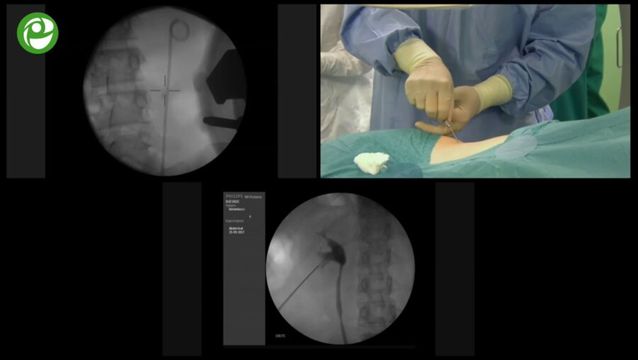 Секция живой хирургии №1