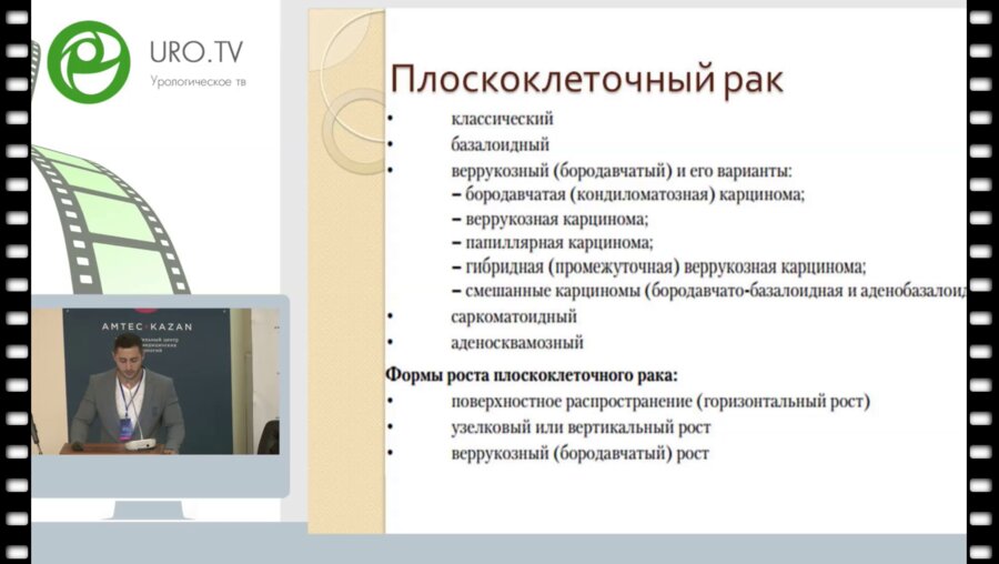 Дзидзария А.Г. - Органосохраняющие методики хирургического лечения рака полового члена