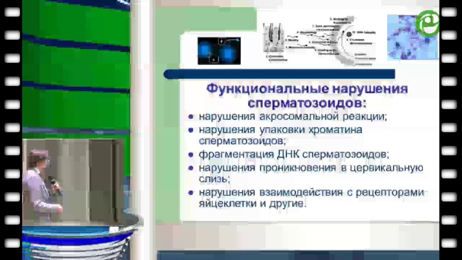 Божедомов В.А. - Бесплодие у мужчин при нормозооспермии