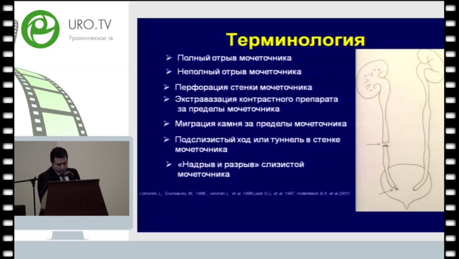 Акопян Г.С. - Сравнительный анализ интраоперационных осложнений при различных вариантах перкутанных нефролитотрипсий