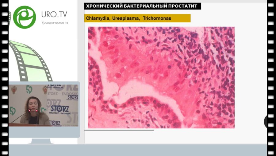 Паклина О.В. -  Аденома простаты глазами морфолога