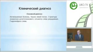ПНЛ мультидоступ (Меринов Д.С.), Перкутанная нефролитотрипсия у ребёнка (Арустамов Л.Д.)