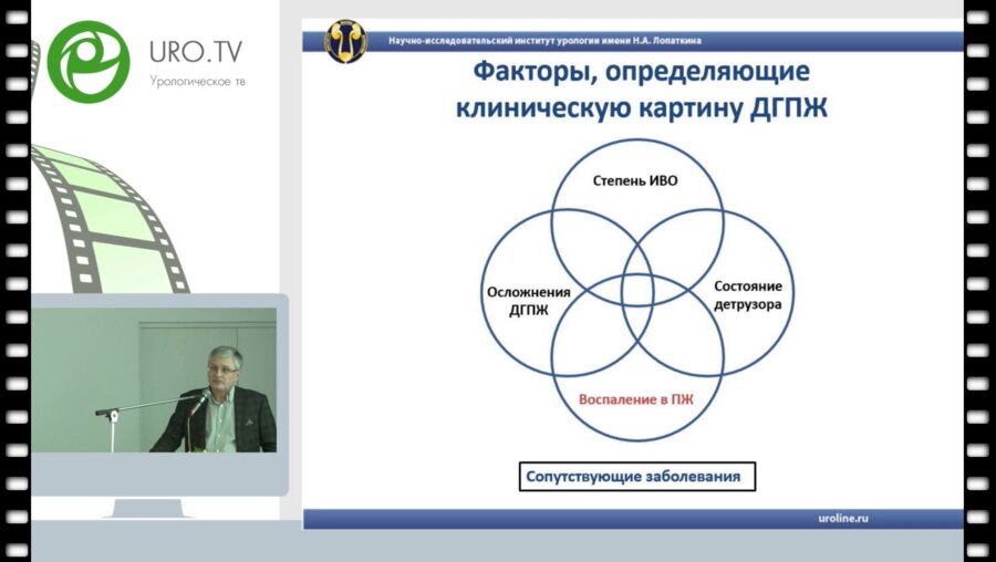 Сивков - Роль воспаления в патогенезе ДГПЖ_1